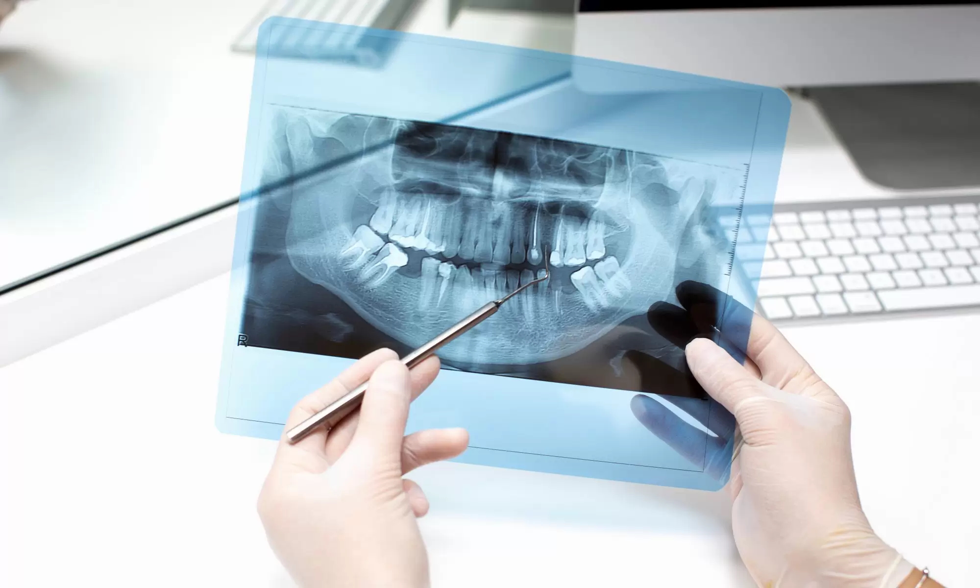 اهمیت تجهیزات دندان‌پزشکی با کیفیت در درمان‌های مؤثر